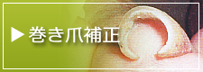 巻き爪補正