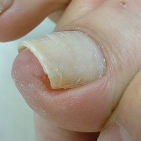 ストロー型2 完了