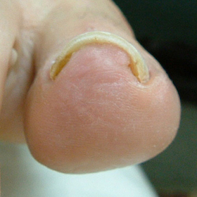 ストロー型1 完了