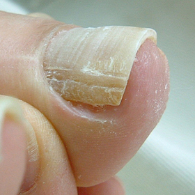 ストロー型3 完了