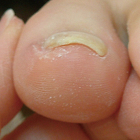 渦巻き型1 完了