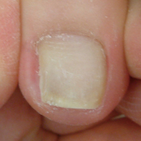 渦巻き型3 完了